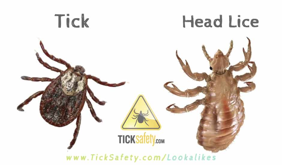 Lookalikes — Tick vs Head Lice